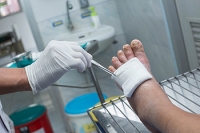 Diabetes and Foot Wounds