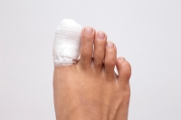Broken Toe Symptoms