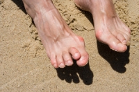 Certain Medical Conditions May Cause Hammertoe